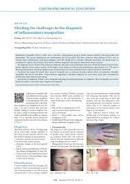 Although, considered uniformly fatal few years ago 1, 2, its early. Pdf Meeting The Challenges In The Diagnosis Of Inflammatory Myopathies