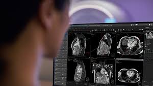 Image result for Cardiac MRI