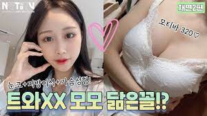 수술하고 트와이스 모모 닮았다는!!? 눈코,지방이식,가슴성형C컵후기ㅣ티안나게 예뻐지는 방법💙 - YouTube