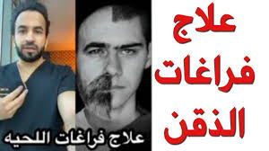 فراغات الذقن او اللحية علاج فعال دكتور طلال Youtube