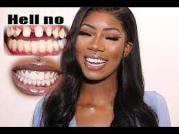 These costs of teeth whitening, including laser whitening costs, depend on where you go and the exact procedure you choose. I Got My Teeth Done Veneers 103 A 80 Teeth Bonds Vanessablac Youtube Teeth Bonding Teeth Halloween Face Makeup