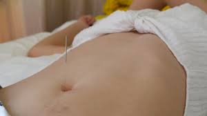 Free shipping on orders over $25 shipped by amazon. Belly Button Navel Needle Torture Dingding Bellycool