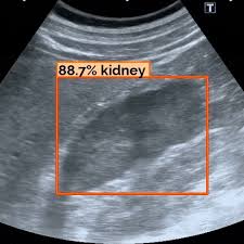 Image result for Ultrasound