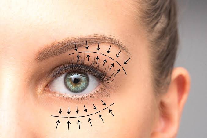 Blepharoplasty Surgeon in Dubai - Eyelid Surgery Dubai