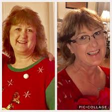 This beautiful lady started her weight loss journey with us and just 5  months later here she is! Can we get a "like" to congratulate Carol!  (Before, Left) (After, Right)