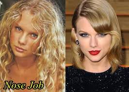 Taylor swift cosmetic surgery like all celebs trigger excellent passion in lots of people! Taylor Swift Plastic Surgery Before And After Nose Job Plastic Surgery Nose Job Celebrity Plastic Surgery