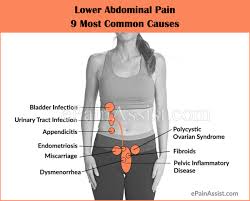 • abdominal walls • abdominal cavity • abdominal viscera. Lower Abdominal Pain 9 Most Common Causes Symptoms Investigations Treatment