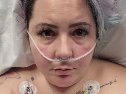 'I paid £4.5k for life-changing weight-loss surgery but ended up in  intensive care'