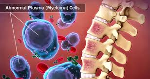 9 Twitter Myeloma Multiple Myeloma Multiple Myeloma Cancer Awareness