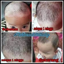 Gunakan natural bubble wash untuk mencuci dan melembutkan rambut. Kulit Kepala Berkerak Hilang Ih S Baby Product Kemaman Facebook