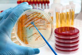 Saluran kencing terdiri daripada organ penghasilan, penyimpanan dan perkumuhan merangkumi buah pinggang, ureter, pundi kencing dan. Bakteri Streptococcus Bisa Sebabkan Penyakit Apa Saja Ini Daftarnya