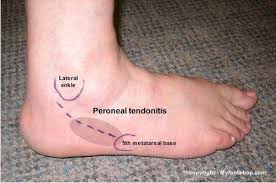 Pin On Anatomie