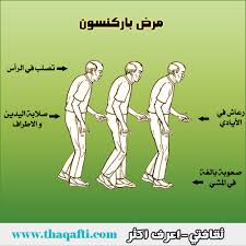 عدم اتزان في المشي اجمل جديد