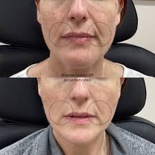 Leah Wheaton MSN,FNP-C (@leahwheaton_np) • Instagram photos and videos