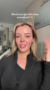 Discover the Incredible Slim Nose Procedure by Expert Doctor Katya!