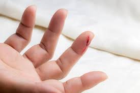Menilik Fungsi Dan Jumlah Normal Trombosit Dalam Tubuh