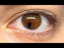 Definition of pupil (entry 2 of 2). A Really Small Pupil Youtube