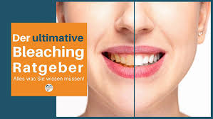 Aufhellungsmittel für die zähne mit wasserstoffperoxid. Zahn Bleaching Methoden Risiken Kosten