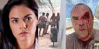 La actriz livia brito y su novio son acusados de una violenta agresión contra ernesto zepeda, que muestra las marcas visibles de los golpes que recibió; Livia Brito Y Su Novio Agredieron A Un Fotografo En Cancun Turquesa News