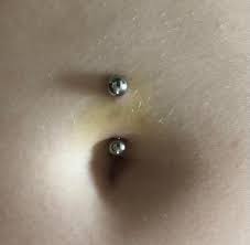 Bruise On Fresh Belly Button Piercing Info In Comments Legitpiercing