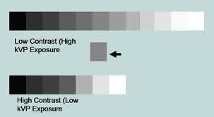 Explain High Low Contrast In Radiograph Radiology Imaging Radiology Schools Radiology Technologist