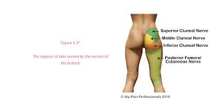 The sciatic nerve runs very close to these muscles and sometimes right through them. Upper Buttock Pain Sacro Illiac Joint Area Pain
