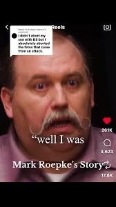 Carl Roepke Teeth Before and After