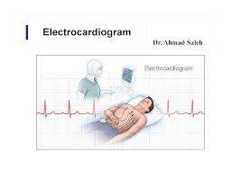Image result for Electrocardiogram