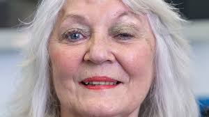 World first: British surgeon removes 'tennis ball-sized' brain tumour  through patients' eyebrow