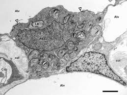 Cells retained on the column were labeled epithelial enriched, and cells that flowed histology of anatomical landmarks in donor lungs. The Micromechanics Of Lung Alveoli Structure And Function Of Surfactant And Tissue Components Springerlink