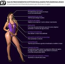 Andressa urach pediu perdão para tati minerato (foto: Portal R7 Cirurgia Intima E Lipoaspiracao Veja Lista De Procedimentos Esteticos De Andressa Urach Http R7 Com 2czk Facebook