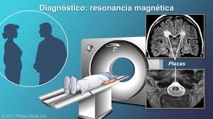 La esclerosis múltiple (em) es una enfermedad autoinmune que hasta el momento no tiene cura. El Diagnostico De La Esclerosis Multiple