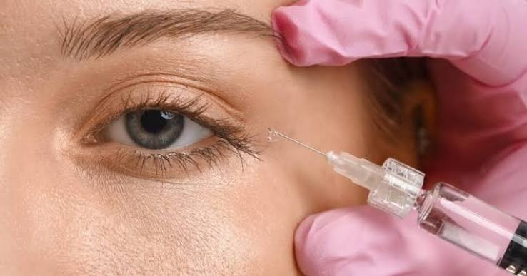 Under-Eye Fillers: All You Need To Know 2026