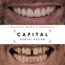 Capital Dental Design Cosmetic Dentist Richmond Virginia 116 Photos Facebook