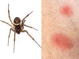 This spider is commonly found in the southern half of the united states and in south america, where it is known as the brown spider. How To Identify And Treat A Spider Bite As Spider Mating Season Continues Daily Star