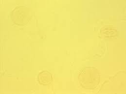 Image result for Pentanisia sykesii