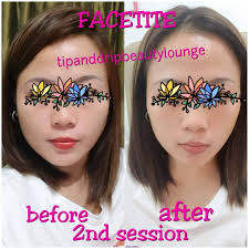 Facetite SILK'N PROMO BEFORE: 700 NOW: 350 FOR YOUTHFULL AND GLOWING SKIN.  FACE CONTOURING.