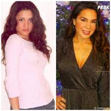 Ainsi que mon second mariage à miami » a ainsi rappelé milla jasmine, « j'ai eu une vie avant la télé, un mariage à 19 ans avec mon premier amour et un autre à l'âge de 24 ans » confie milla jasmine à sa. Manon Marsault Milla Jasmine Julia Paredes Les Avant Apres Chirurgie Esthetique Des Candidates Purebreak