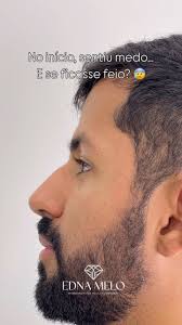 Link na bio 🤍🤏🏻