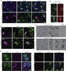 Tau Protein Disrupts Nucleocytoplasmic Transport in Alzheimer's Disease