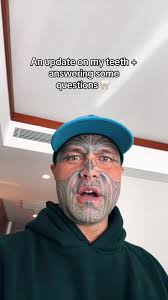 Teeth Journey Update with Vera Smile Dental Clinic