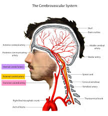 The carotid arteries are a group of arteries that rise up the neck to supply oxygenated blood to the brain, face and many other parts of the head. Carotid Artery Disease Stenosis Carotid Artery Dissection