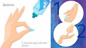 Putting your lenses in the case, instead of resting them on your sink or on a napkin, reduces the risk of picking up debris. Cleaning Contact Lenses Coopervision