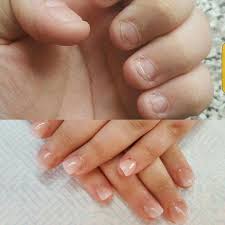 I bite my nails and they are very short, shorter then ive ever seen a biter have. Badly Bitten Nails To Ombre Acrylic Fully Sculptured Acrylic Nails Nailporn Acrylics Scu Sculptured Acrylic Nails Natural Acrylic Nails Short Acrylic Nails