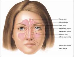 Image result for Rhinosinusitis