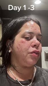 Minkology 101 Miss E Before and After Extraction