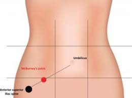 The fruit is delicious on its own or tossed into iced tea for a fruity twist. Your Appendix A Built In Probiotic Nutriplexity