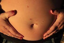 Can Prenatal Vitamins Make You Gain Weight