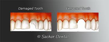Our powerful toothpaste collection helps reverse early gum damage. Dentist Nyc Tooth Extraction Nyc Sachar Dental Nyc
