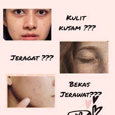 Ann Ell Aisyah Ibrahim